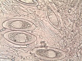 Pertusaria hymenea image