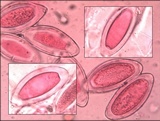Pertusaria hymenea image