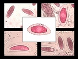 Pertusaria hymenea image