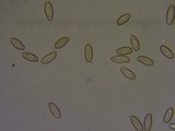 Xerocomellus diffractus image