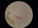 Blastomyces dermatitidis image