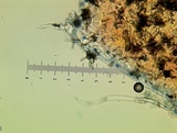 Venturia inaequalis image