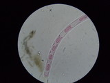 Sarcoscypha austriaca image