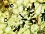 Thielaviopsis basicola image