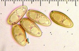 Tylopilus porphyrosporus image