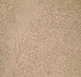 Hohenbuehelia angustata image