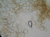 Coprinellus xanthothrix image
