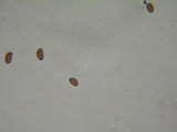 Coprinellus xanthothrix image