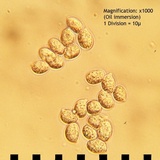 Armillaria gallica image