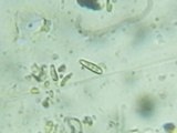 Toninia aromatica image