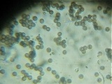 Badhamia foliicola image