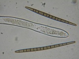 Trichoglossum hirsutum image