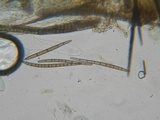 Trichoglossum hirsutum image