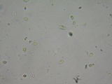 Hohenbuehelia petaloides image