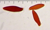 Lepiota magnispora image
