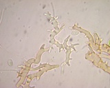 Nidula candida image