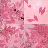 Parasola conopilea image
