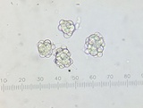 Hypomyces papulasporae image