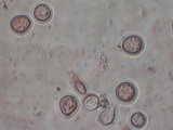 Tulasnella violea image