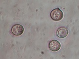 Tulasnella violea image