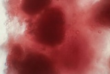 Tulasnella violea image