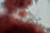 Tulasnella violea image