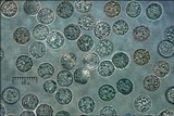 Lycogala epidendrum image