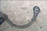 Lycogala epidendrum image