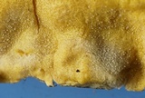 Trichoderma sulphureum image