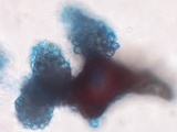 Tulasnella violea image