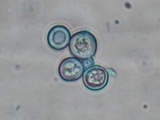 Tulasnella violea image