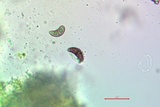 Rinodina santae-monicae image