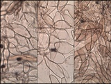 Coprinellus xanthothrix image