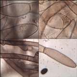 Coprinellus xanthothrix image