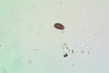 Rinodina santae-monicae image