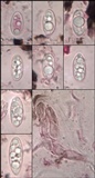 Lecidella asema image