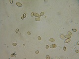 Hebeloma collariatum image