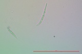 Collema subnigrescens image