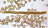 Lycoperdon umbrinum image