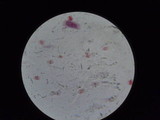 Nolanea verna var. isodiametrica image