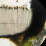 Stictis urceolata image
