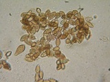 Hebeloma cavipes image