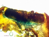 Aspicilia cyanescens image