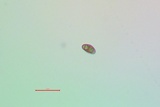 Rinodina laevigata image