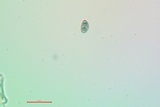 Rinodina laevigata image