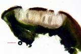 Acarospora obnubila image