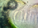 Acarospora obnubila image