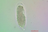 Acarospora obnubila image