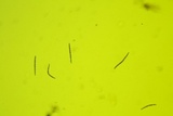 Trichoglossum octopartitum image