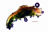 Acarospora fuscata image